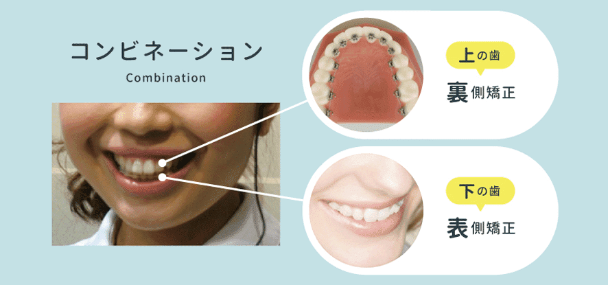 コンビネーション（上が裏側／下が表側）