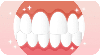 ホワイトニング