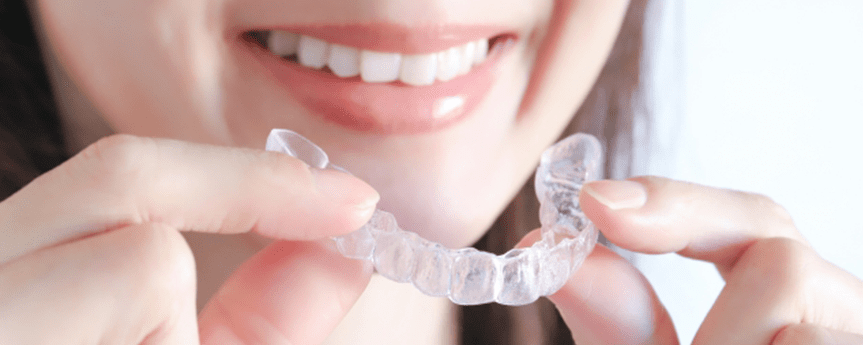 ホームホワイトニング