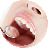 むし歯の再発が少ない