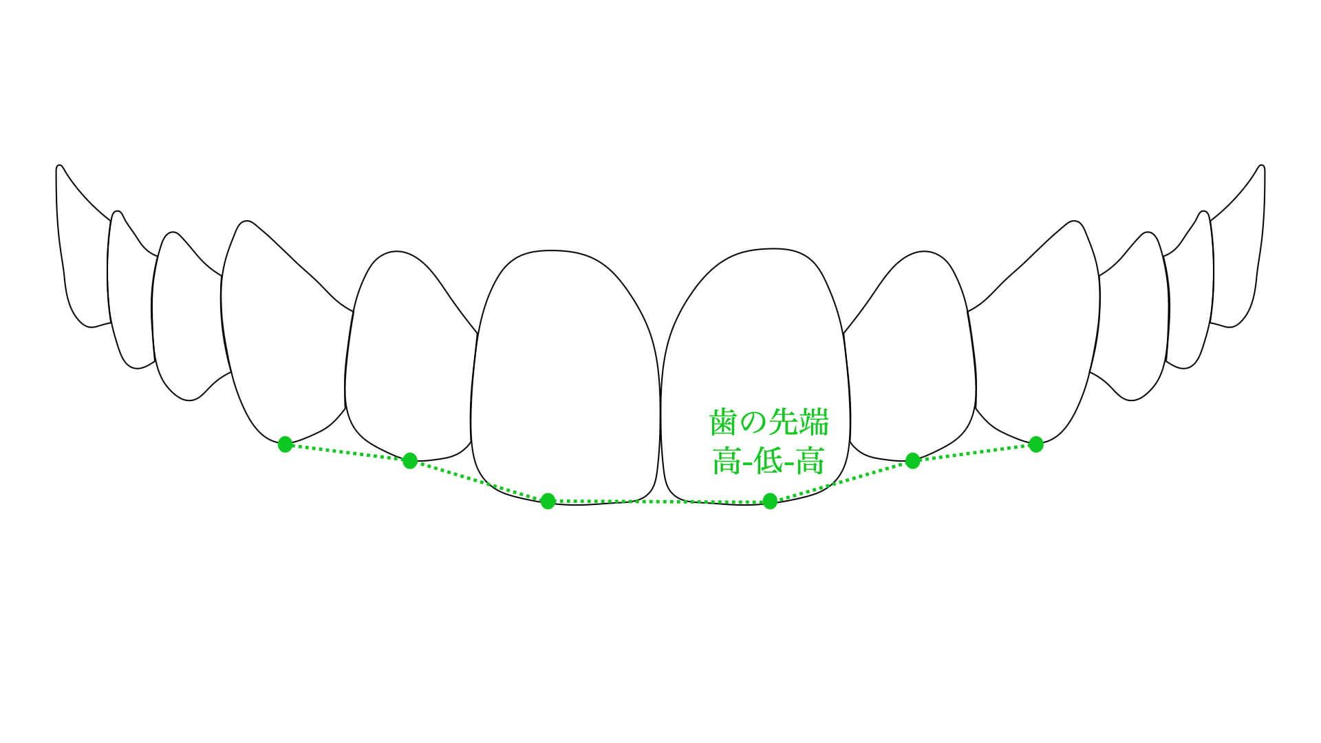 美しいとされる歯の先端を結んだライン