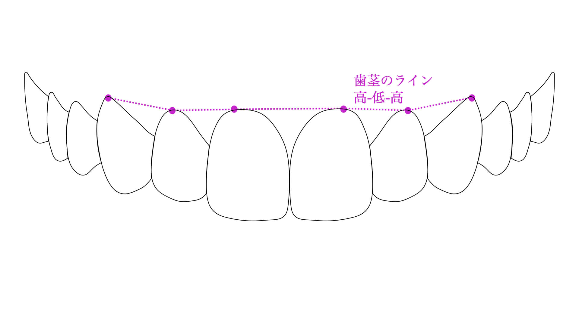 美しいとされる歯茎のライン
