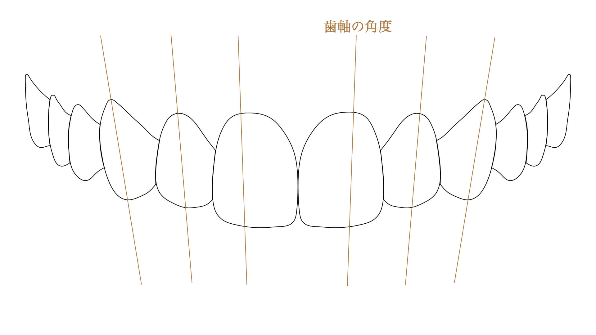 美しいとされる歯（歯軸）の角度